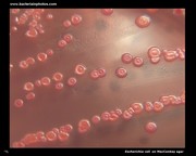 appearance of lactose positive colonies on MacConkey